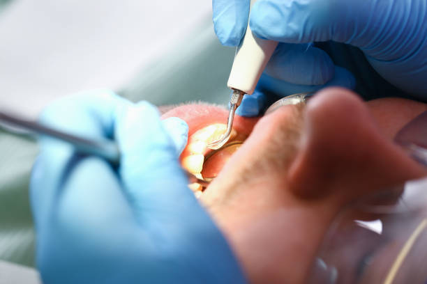 Best Emergency Dental Surgery in Mcallen, TX