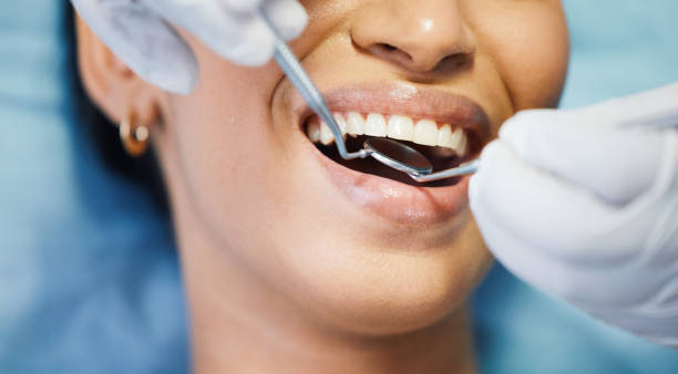 Best Emergency Tooth Extraction in Mcallen, TX